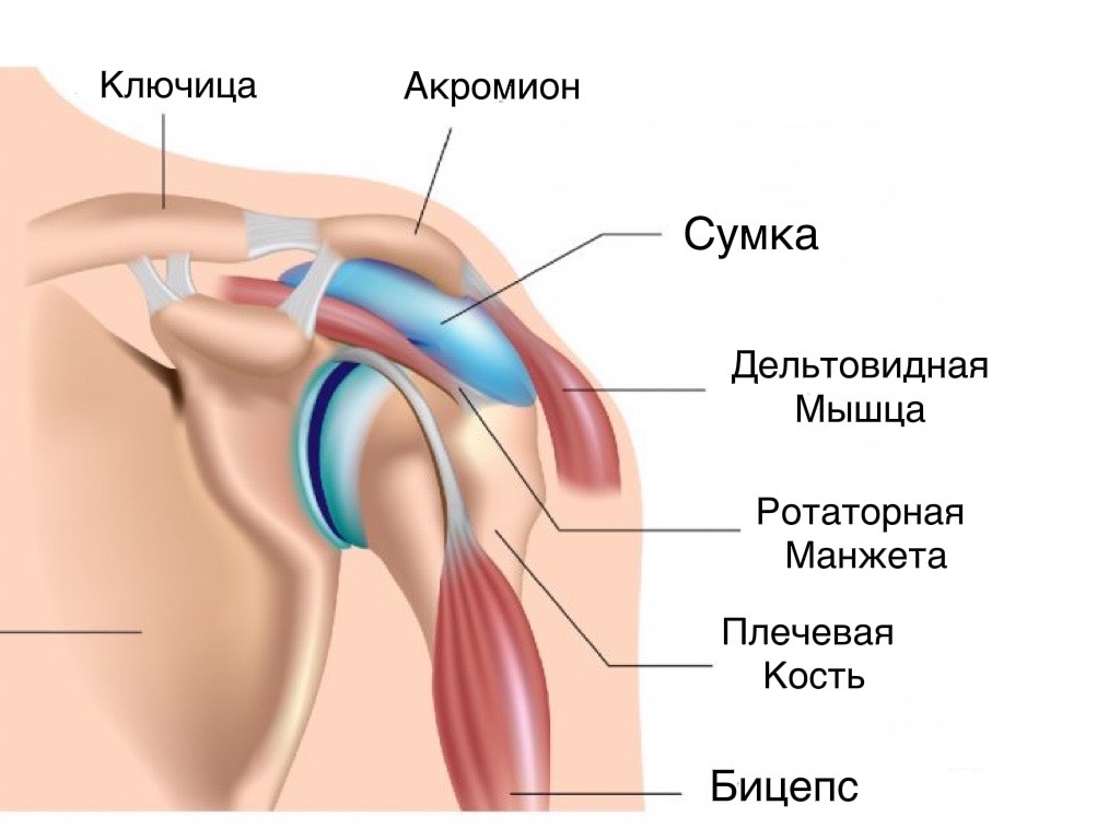 Бурсит плечевого сустава - картинка