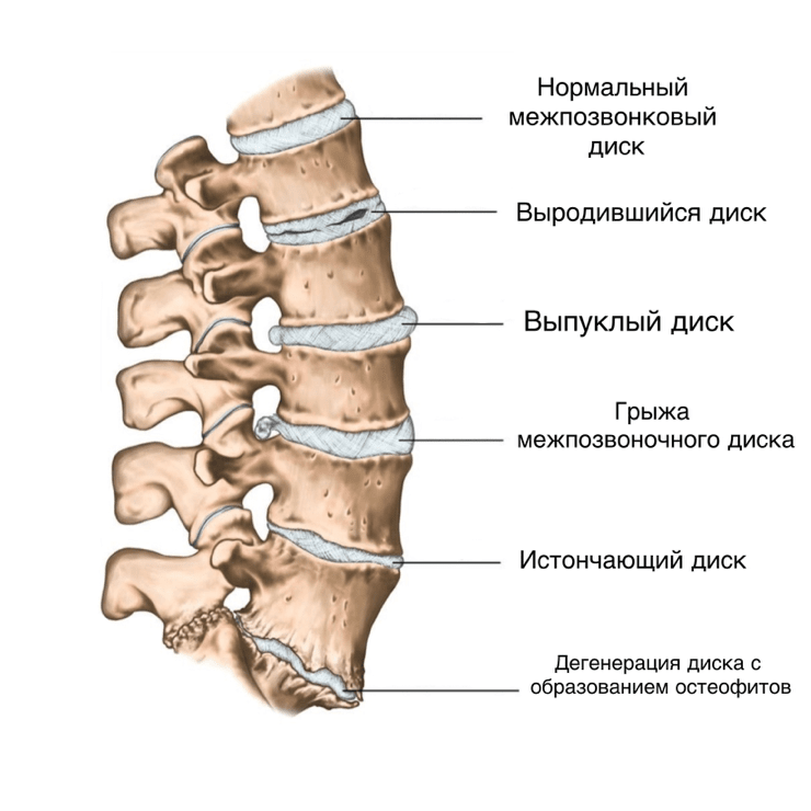 ДДЗП -картинка