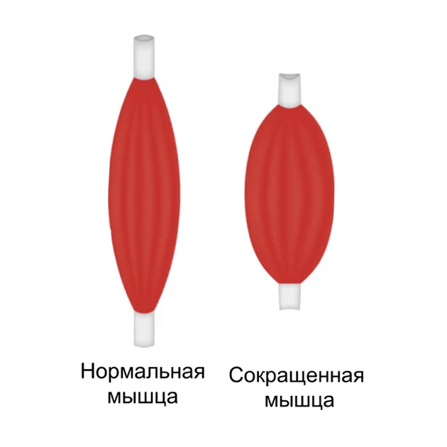 Лечение контрактуры